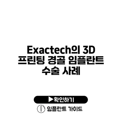 Exactech의 3D 프린팅 경골 임플란트 수술 사례